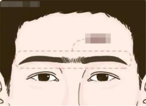 “Chân mày giao” hay lông mày nối liền là tình trạng hai đầu chân mày gần nhau hoặc liền thành một đường trên gương mặt.