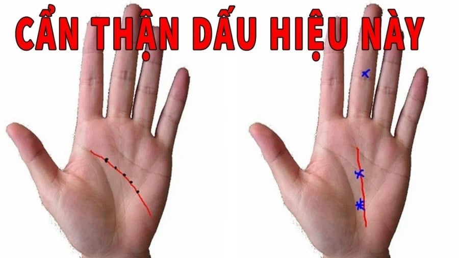 Tướng tay nghèo khổ 