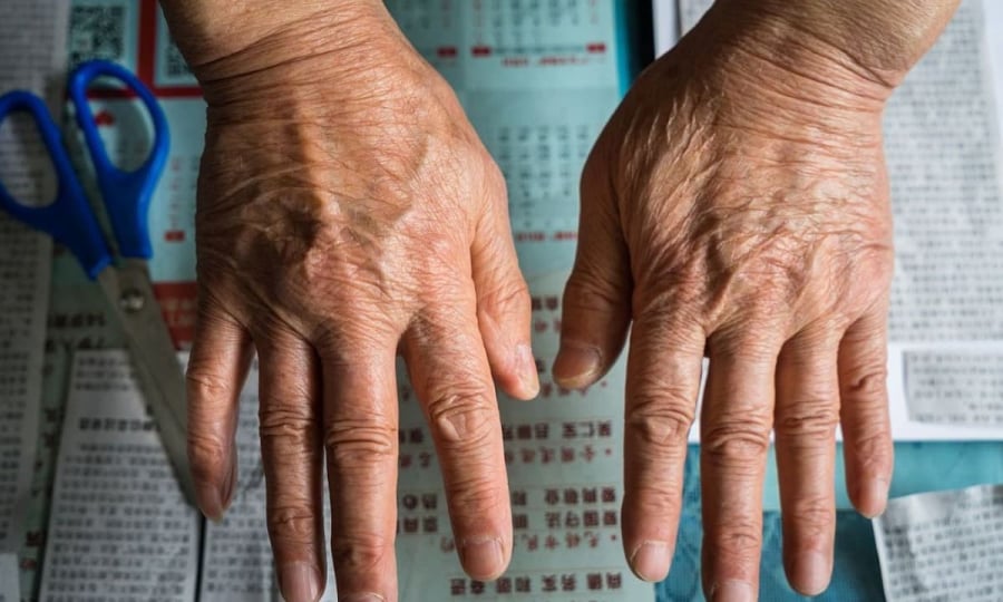 Những người có lực nắm tay yếu thường đối mặt với nguy cơ tử vong cao hơn, dễ mắc các bệnh tim mạch, suy giảm chức năng cơ thể và mất khả năng vận động. 