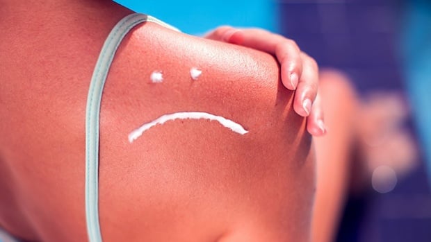 Việc xử lý kịp thời và đúng cách sẽ giúp giảm viêm, phục hồi da nhanh hơn và hạn chế những ảnh hưởng lâu dài.