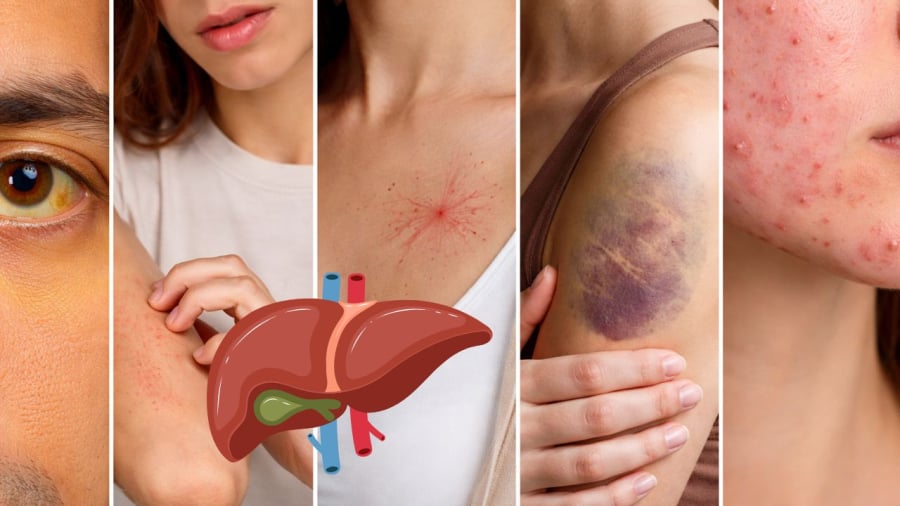 Khi ngoài da thường xuyên có các dấu hiệu này thì chớ có chủ quan