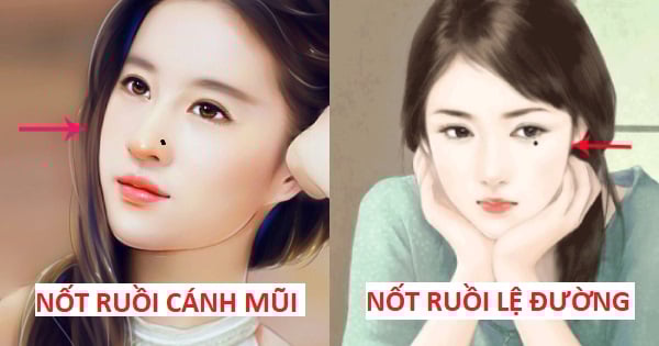 Nốt ruồi cản trở tài lộc