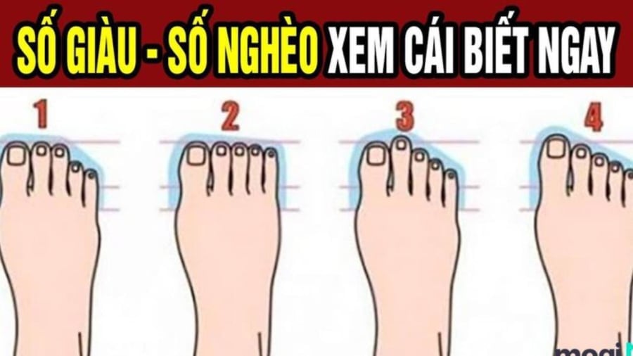 Tướng bàn chân phát tài