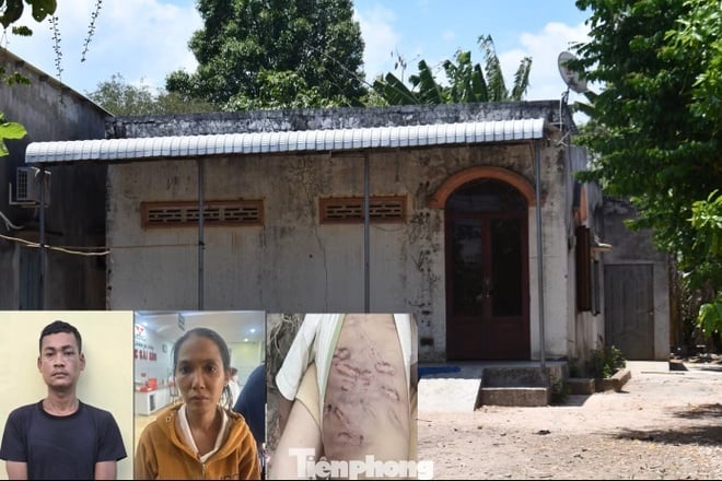 Theo lãnh đạo UBND xã Hòa Hiệp, ngày 4/5, địa phương đã phối hợp làm việc với Trung tâm Công tác xã hội giáo dục dạy nghề thiếu niên TP.HCM, Trung tâm Bảo trợ và Công tác xã hội (đóng tại tỉnh Bà Rịa - Vũng Tàu cũ), Hội Bảo vệ quyền trẻ em TP.HCM cùng các bác sĩ Bệnh viện Nhi đồng 1 TP.HCM - nơi bé K. đang được điều trị.    