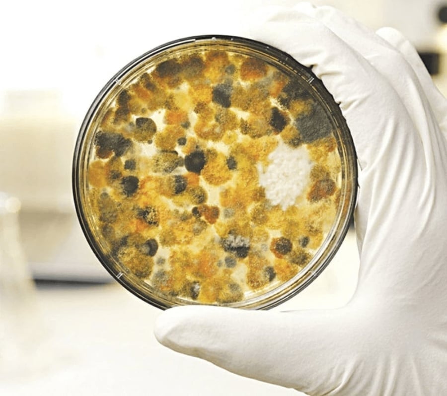 Một trong những yếu tố nguy cơ được nhắc đến là Aflatoxin – độc tố vi nấm sinh ra từ một số loài nấm thuộc nhóm Aspergillus, thường xuất hiện trong thực phẩm bị mốc. 