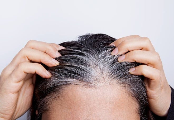Tình trạng tóc bạc sớm, tóc thưa và gãy rụng ngày càng xuất hiện nhiều ở phụ nữ trẻ do áp lực, thức khuya hoặc chế độ ăn uống thiếu cân bằng.