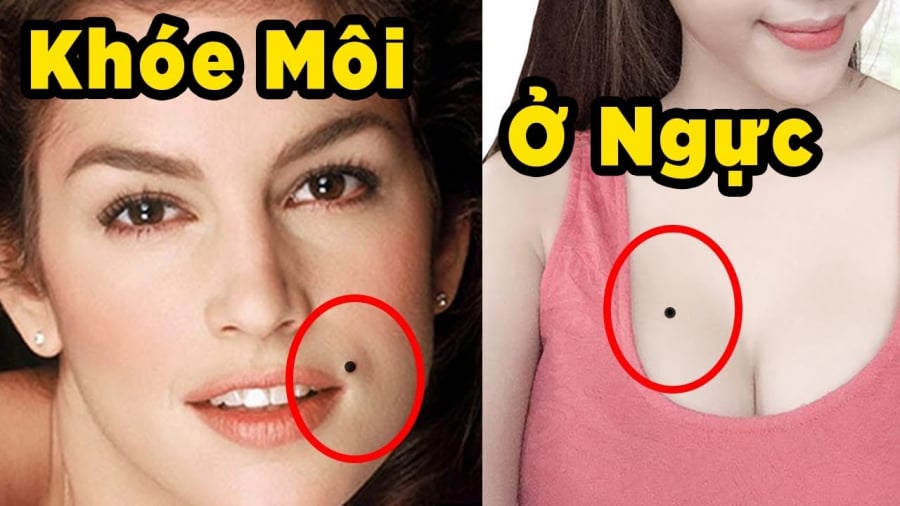 not ruoi