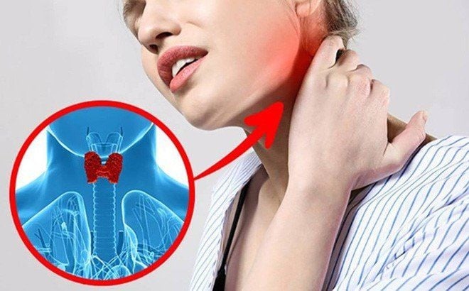 5 dấu hiệu K tuyến giáp mới chớp: Biết sớm chữa là khỏi