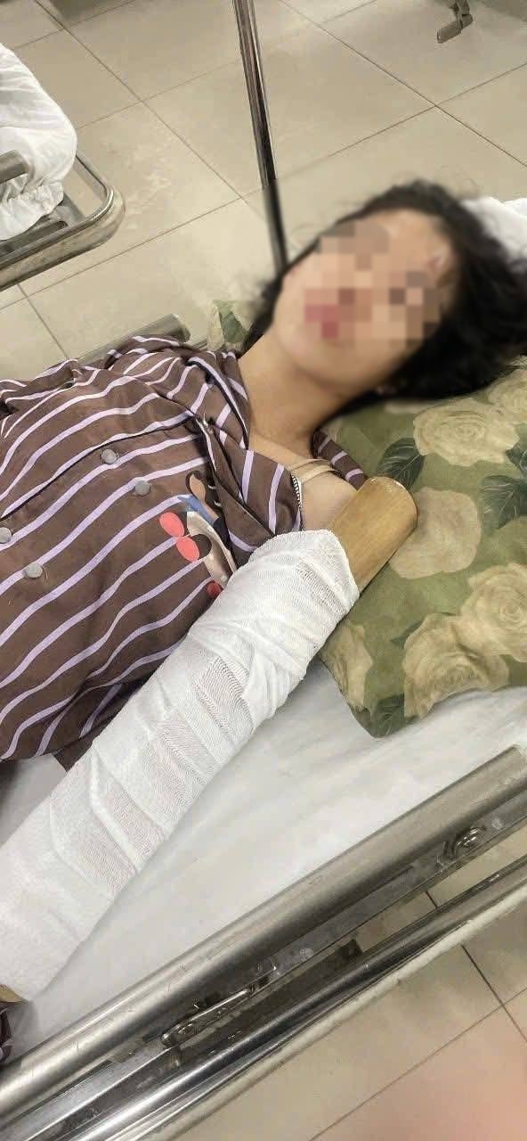 Hiện chị Y. đang điều trị tại Bệnh viện Đa khoa Bình Dương. 