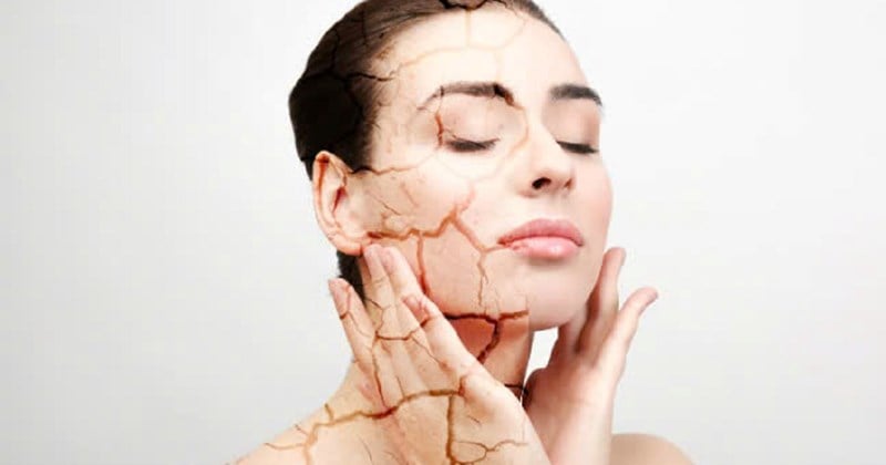 Một trong những cách hiệu quả nhất để hạn chế tác động của tia UV là sử dụng kem chống nắng đúng cách mỗi ngày. 