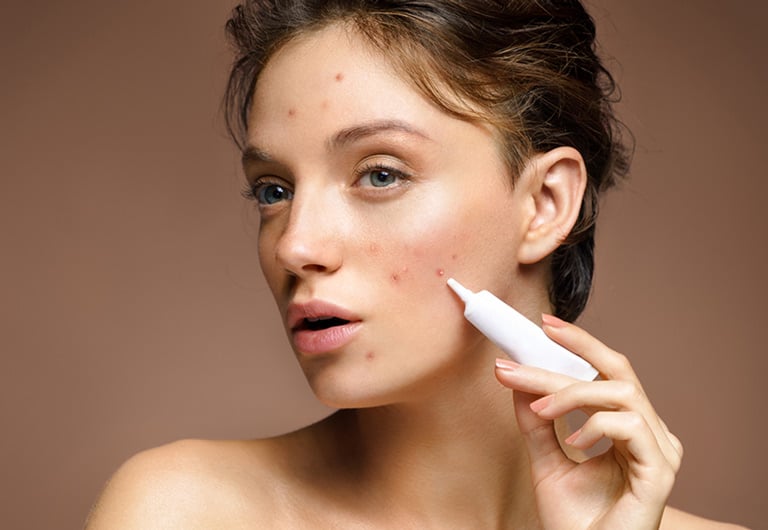 Vitamin C là một trong những hoạt chất được sử dụng phổ biến trong các chu trình chăm sóc da có tình trạng thâm sau mụn. 