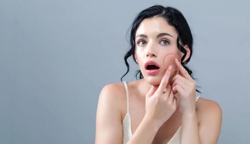 Nếu chăm sóc không phù hợp, tình trạng viêm có thể kéo dài và kích thích cơ thể tăng sản sinh melanin, từ đó hình thành các vết thâm sau mụn.