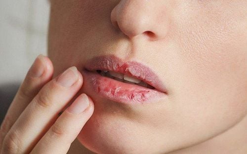 Trên thực tế, cặn son môi và mỹ phẩm còn sót lại có thể khiến môi trở nên khô ráp, xỉn màu và dễ bong tróc hơn.