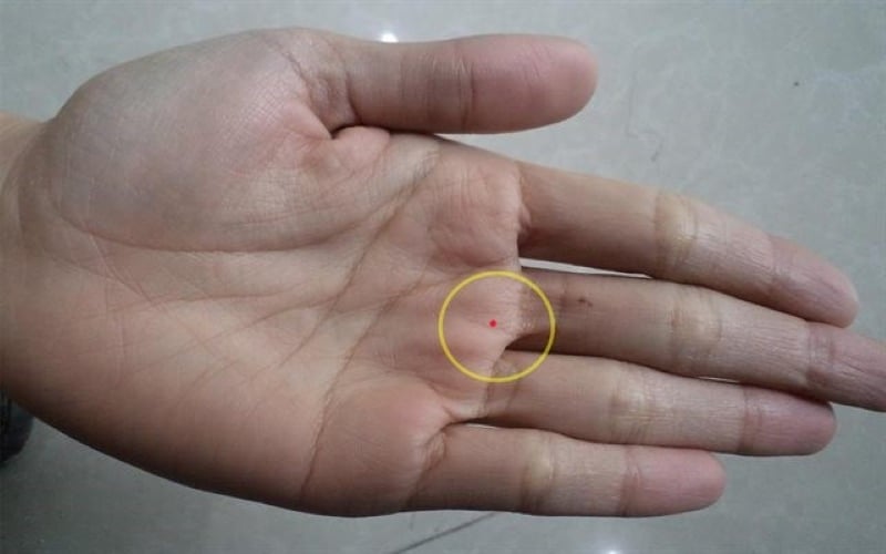 Nṓt ruṑi mang tới may mắn