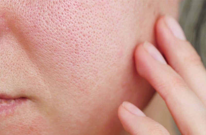 Sau bước làm sạch, việc bổ sung các hoạt chất đặc trị đóng vai trò quan trọng trong quá trình cải thiện kết cấu da.    