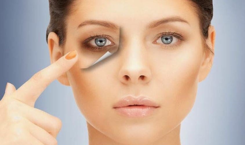  Điều này khiến da trở nên nhợt nhạt, làm các mạch máu dưới da hiện rõ hơn và tạo cảm giác vùng mắt sẫm màu.