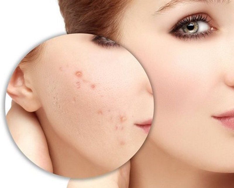 Các sản phẩm bôi ngoài da chỉ đóng vai trò hỗ trợ trong quá trình chăm sóc và phục hồi.