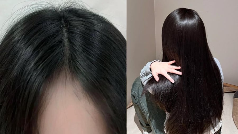 Sử dụng vitamin B1 có tác dụng kích thích mọc tóc.