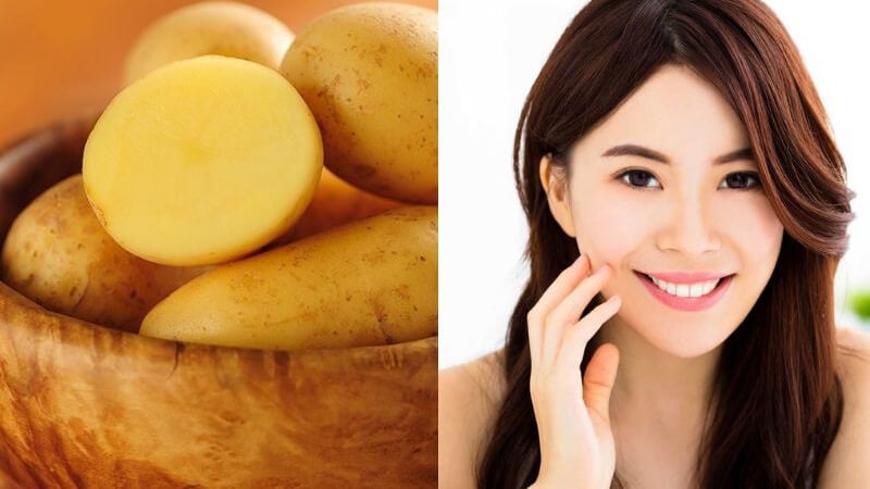 Khoai tây chứa nhiều vitamin C cùng các chất chống oxy hóa có lợi cho làn da.