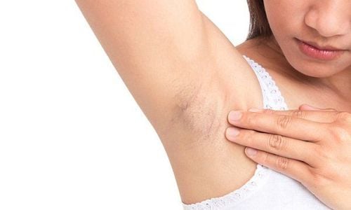 Việc tẩy tế bào chết định kỳ giúp làm sạch lớp sừng già cỗi, hỗ trợ lỗ chân lông thông thoáng hơn và cải thiện độ sáng của da