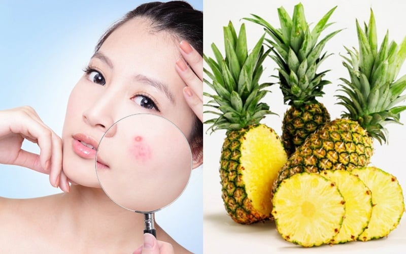 Dứa có hàm lượng nước cao, chiếm khoảng 85–86% khối lượng quả, giúp bổ sung nước cho cơ thể và góp phần duy trì độ ẩm tự nhiên của da.