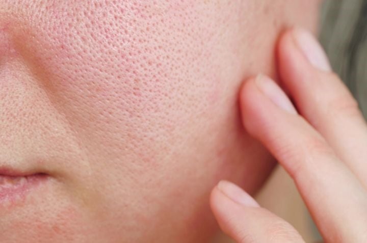 Bước đầu tiên cần ưu tiên là làm sạch theo hướng nhẹ nhàng thay vì cố gắng loại bỏ hoàn toàn dầu thừa trên da.