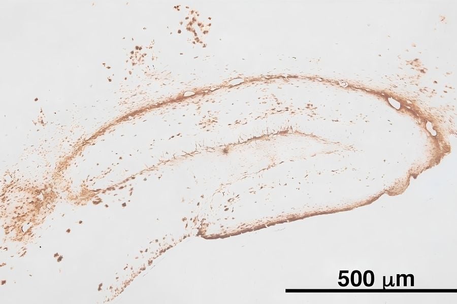 peak-1-amyloid-beta