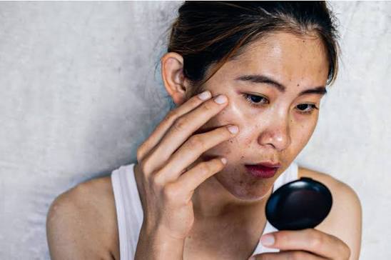 Ánh nắng mặt trời là một trong những nguyên nhân hàng đầu khiến làn da trở nên sạm màu.