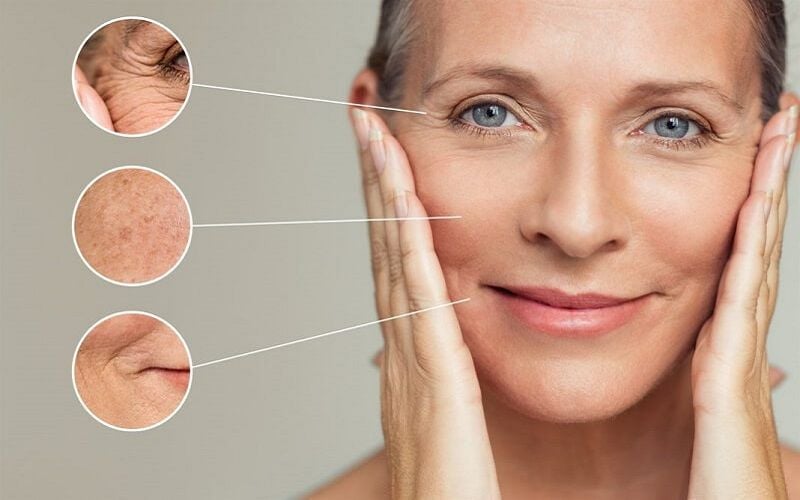 Sự thiếu hụt collagen không chỉ ảnh hưởng đến chất lượng làn da mà còn làm thay đổi cấu trúc khuôn mặt.    