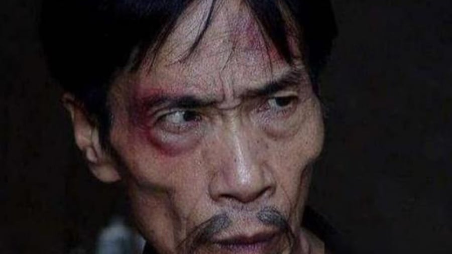 Tại sao người hai má không có thịt không nên kết giao?