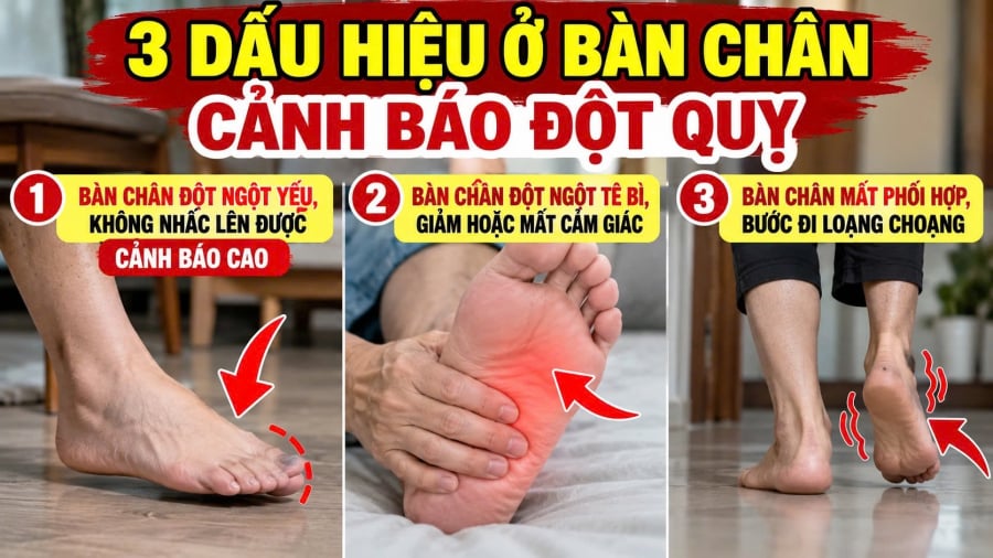 Đột quỵ thường xảy ra đột ngột và có thể để lại những di chứng nghiêm trọng nếu không được cấp cứu kịp thời. Bên cạnh các biểu hiện quen thuộc như méo miệng, nói khó, yếu tay, những thay đổi bất thường ở bàn chân và khả năng đi lại cũng có thể là dấu hiệu cần đặc biệt cảnh giác.    