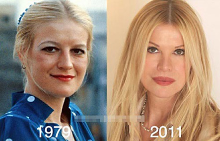 Cindy Jackson trước và sau khi phẫu thuật