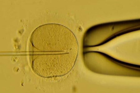  Trong đĩa thí nghiệm, nếu tinh trùng không đủ sức tự bơi tới gặp trứng, bác sĩ sẽ áp dụng kỹ thuật ICSI – tiêm tinh trùng vào bào tương trứng, giúp trứng được thụ tinh dễ dàng. 