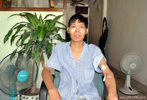 Anh Đông bị đánh sưng vù mặt. Ảnh Infonet