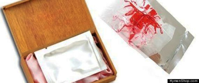 Theo thông tin trên HymenShop, “bộ sản phẩm” kỳ lạ nói trên bao gồm 1 gói máu giả và 1 tấm “màng” có giá 30 đô la (tương đương khoảng 630.000 đồng). Sản phẩm này được cho là có nguồn gốc từ Hong Kong. Lời quảng cáo gây “sốc” trên website cho biết, màng trinh giả sẽ cứu vãn những cuộc hôn nhân và giúp phụ nữ lừa dối chồng rằng họ vẫn còn trinh. Hiện tại, bộ sản phẩm đặc biệt nói trên chỉ bán cho những người mua tại Mỹ.