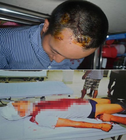 Một vụ án do uống nhiều bia, mất kiểm soát hành vi: do mâu thuẫn ở quán bia, một số thanh niên đã dùng dao chém liên tục vào đầu, đùi và lấy ghế, bát đĩa đập vào đầu anh Nguyễn Văn Điệp khiến anh này bất tỉnh rồi bỏ đi vào ngày 3/9, tại 1 nhà hàng ở huyện Từ Liêm, Hà Nội.