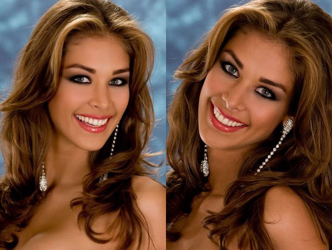  Hoa hậu Hoàn vũ 2008 Dayana Mendoza cũng từng phẫu thuật thẩm mỹ.  