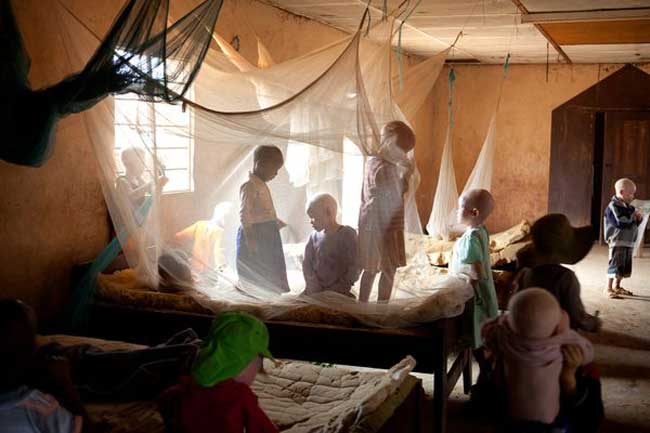 Trên thế giới có không ít người mắc phải căn bệnh bạch tạng nhưng ở châu Phi, nhất là Tanzania thì việc một người da đen bị mang trong mình căn bệnh này coi như là mang án tử hình. Từ năm 2006, có tới 71 người bạch tạng ở quốc gia này đã bị giết chết và 29 người khác bị tấn công. Cứ 1400 người ở Đông Phi thì có 1 người mắc bệnh này, tỉ lệ này cao hơn nhiều so với thế giới (1/20000 dân). Những quan điểm sai lầm về căn bệnh này đã ăn sâu vào gốc dễ của người dân nơi đây.