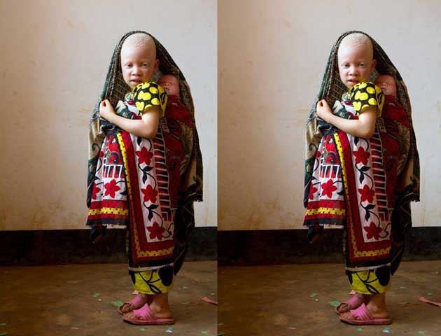 Bé Jessica 3 tháng tuổi được mẹ mang tới khi dân làng đe dọa làm tổn thương. Các anh chị của em cũng phải trốn tới trung tâm để sống sau khi người chị cả bị tấn công. Cha em đã bị thương khi cô gắng bảo vệ con mình. Nhiều đứa bé sẽ không có cơ hội gặp lại cha mẹ hoặc chỉ có mẹ nuôi dưỡng do những quan niệm cổ hủ ăn sâu vào con người nơi đây.