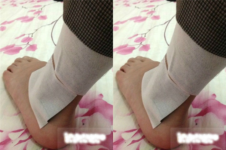  Sau buổi biểu diễn tối qua, Bùi Anh Tuấn đã khoe hình vết thương ở đôi chân - hậu quả của một màn quá khích từ những anti fan nóng nảy.