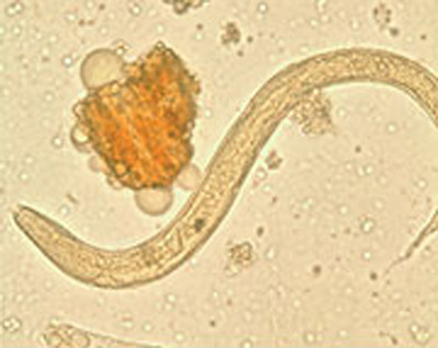 Loài giun Strongyloides stercoralis có khả năng chờ đợi trong ruột người hàng chục năm cho đến khi có cơ hội đi tới các cơ quan trong cơ thể