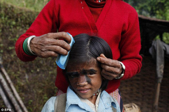 Mangali Thmi, mẹ của Bhawana Thmi đang chải tóc cho cô con gái bé nhỏ trước khi cô bé trở lại trường học và được cộng đồng chấp nhận