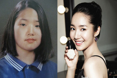 Park Min Young trước và sau phẫu thuật thẩm mỹ