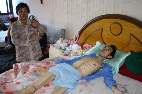 Một bệnh nhân ung thư ở thành phố Vô Tích thuộc tỉnh Giang Tô. Nguyên nhân gây bệnh chưa rõ song người này khẳng định do ông dùng nước nhiễm hóa chất công nghiệp ở địa phương. (Ảnh: Greenpeace)