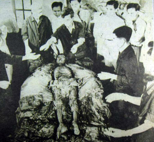 Các chuyên gia xem xét xác ướp vua Lê Dụ Tông.