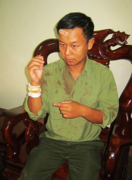 Anh Lê Thanh Hòa và những vết thương do người dân hành hung