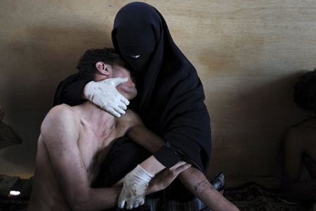 Một người phụ nữ che kín mặt đang ôm chặt người thân bị thương trên tay sau cuộc biểu tình tại Yemen - Bức ảnh của nhiếp ảnh gia người Tây Ban Nha Samuel Aranda.