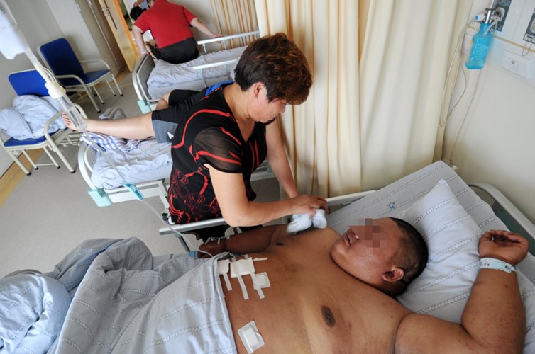 Anh chàng này đã tiến hành phẫu thuật thắt 2/3 dạ dày tại Bệnh viện Nhân dân tỉnh Giang Tô trong nỗ lực giảm cân của mình.