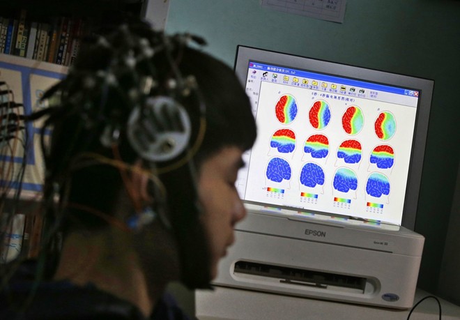 Một cậu bé nghiện Internet đang được quét não để phục vụ mục đích nghiên cứu tại Trung tâm cai nghiện Daxing ở Bắc Kinh.