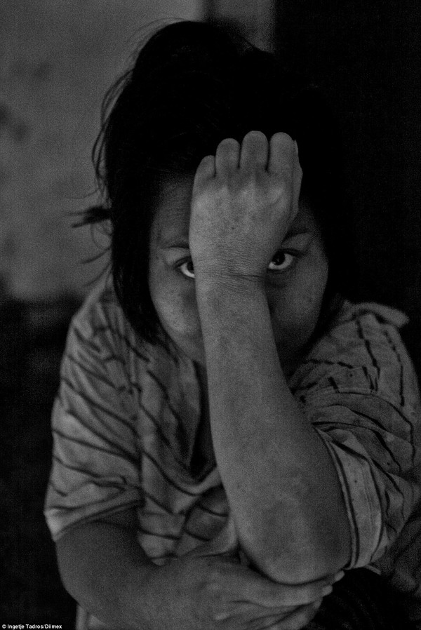 Kedek là 1 trong 300 bệnh nhân mắc bệnh tâm thần nặng ở Bali. Không có khả năng kiếm tiền, họ thường bị chính người thân nhốt vào những chiếc chuồng, thậm chí là chiếc lồng giam giữ chật hẹp.